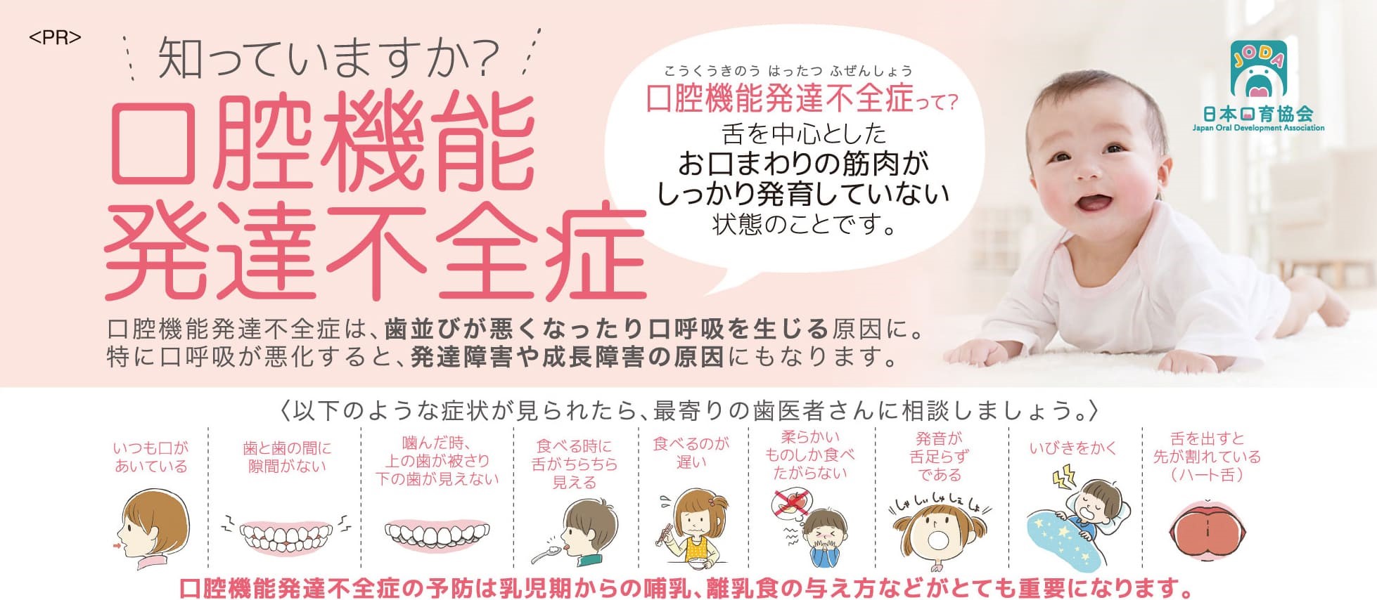 お子さんの「お口ポカン」や「食べこぼし」、気になりませんか？ もしかしたら「口腔機能発達不全症」かもしれません。
